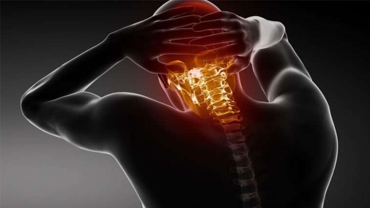 bolesť v zadnej časti hlavy s cervikálnou osteochondrózou